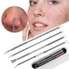 Blackhead Remover Face Deep T Zone Acne Pimple Removal Pore Cleaner Nose Vacuum Facial Diamond Beauty Care SPA Tool Skin - Vimost Shop