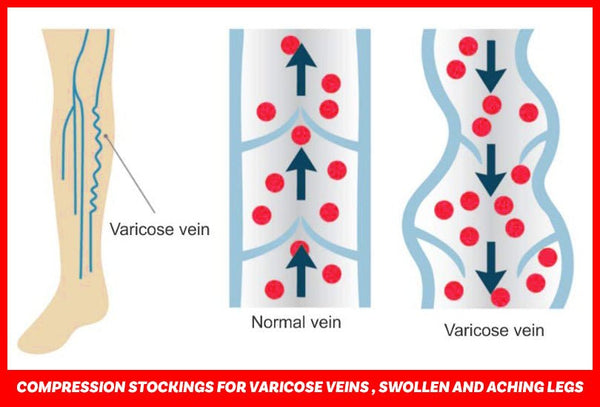 Compression Stockings(20-30 MmHg) for Men & Women - Medical,Athletic,Edema,Diabetic,Varicose Veins,Travel,Pregnancy,Shin Splints - Vimost Shop