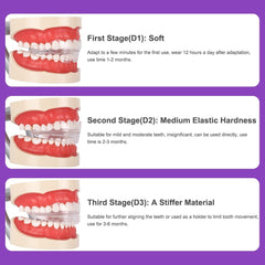 Dental Appliance Tooth Orthodontic Braces Trainer Dental Braces Teeth Trainer Alignment Braces Mouthpiece For Adults Orthodontic - Vimost Shop