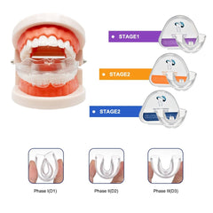 Dental Appliance Tooth Orthodontic Braces Trainer Dental Braces Teeth Trainer Alignment Braces Mouthpiece For Adults Orthodontic - Vimost Shop