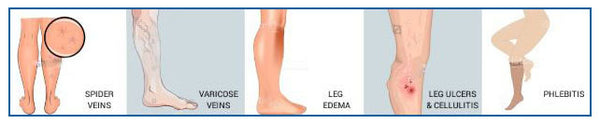 Thigh High Compression Socks Women & Men -Best Medical,Nursing,Hiking,Varicose,Travel Flight Socks-Running & Fitness 20-30 mmHg | Vimost Shop.