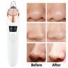 Vacuum Suction Blackhead Remover USB Rechargeable Facial Pore Cleaner Comedone Spot Acne Pimple Black Head Extractor  Care Tools | Vimost Shop.