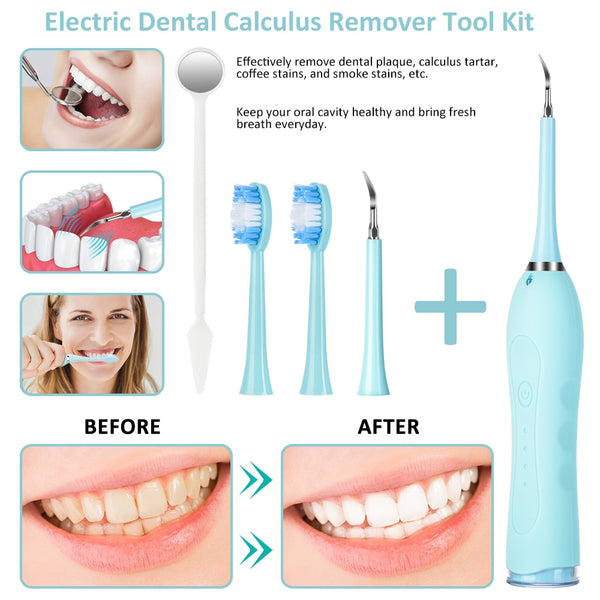 Electric Ultrasonic Sonic Dental Scaler Tooth Calculus Remover Cleaner High Frequency Tooth Stains Tartar Tool Whiten Teeth New | Vimost Shop.